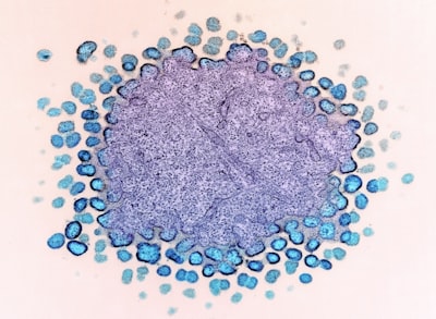 Chromium Deficiency: Signs, Causes, Testing & Treatment Guide 2026